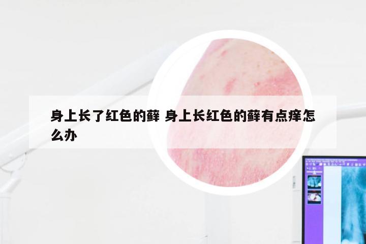 身上长了红色的藓 身上长红色的藓有点痒怎么办