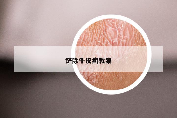 铲除牛皮癣教案