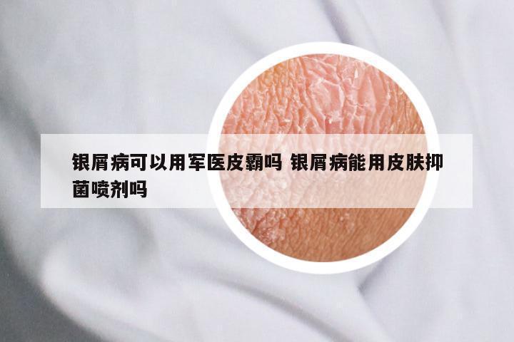 银屑病可以用军医皮霸吗 银屑病能用皮肤抑菌喷剂吗