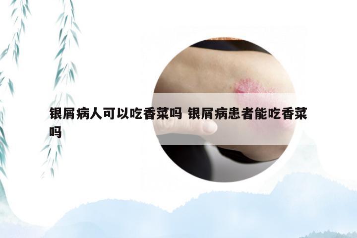 银屑病人可以吃香菜吗 银屑病患者能吃香菜吗