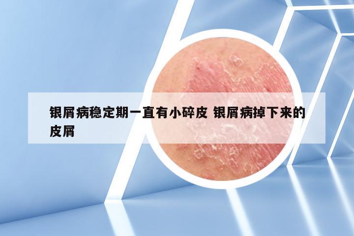 银屑病稳定期一直有小碎皮 银屑病掉下来的皮屑