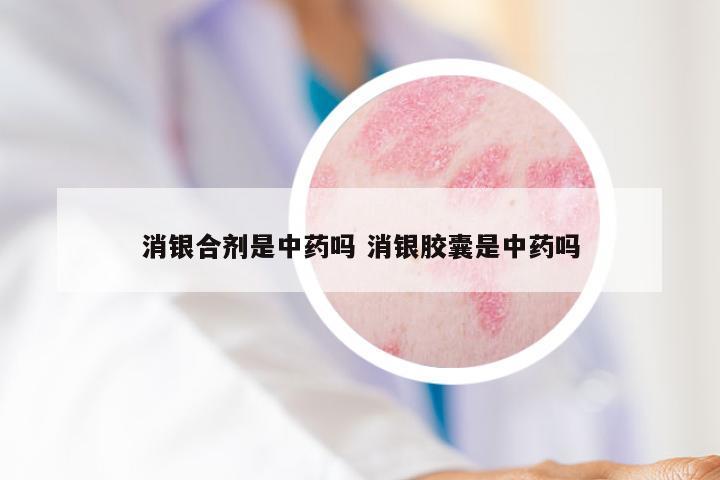 消银合剂是中药吗 消银胶囊是中药吗