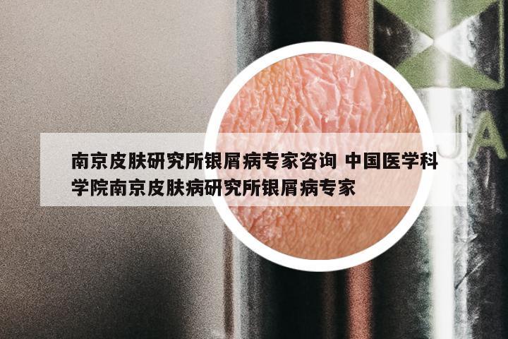 南京皮肤研究所银屑病专家咨询 中国医学科学院南京皮肤病研究所银屑病专家