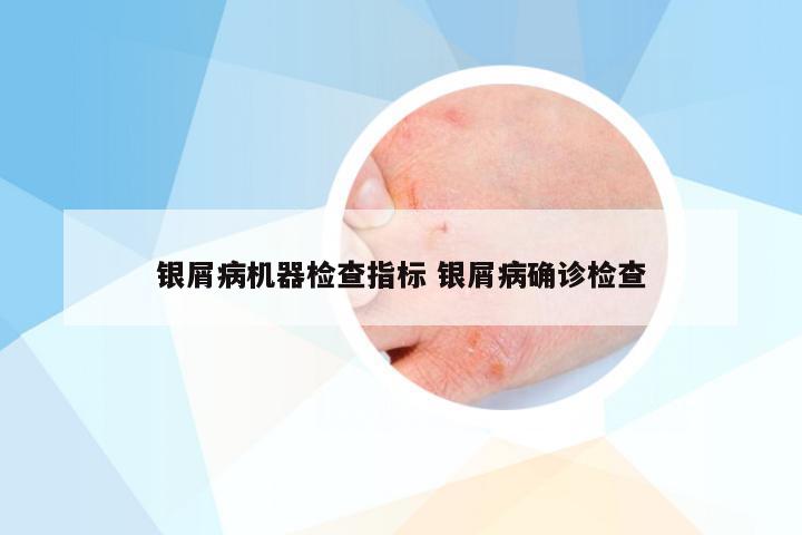 银屑病机器检查指标 银屑病确诊检查