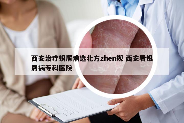 西安治疗银屑病选北方zhen规 西安看银屑病专科医院