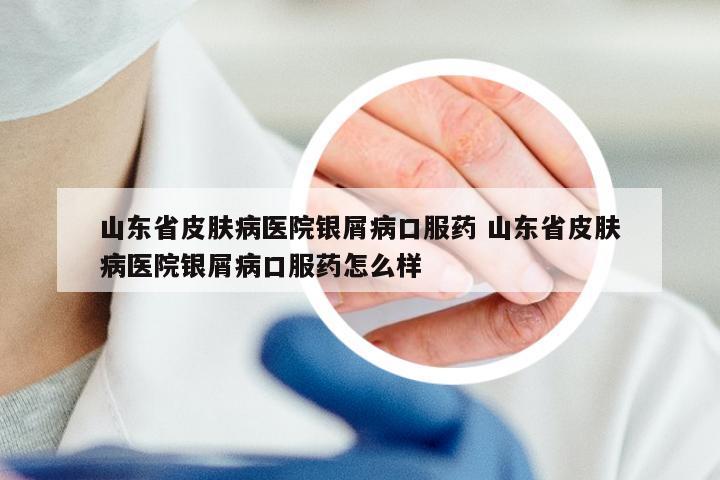 山东省皮肤病医院银屑病口服药 山东省皮肤病医院银屑病口服药怎么样