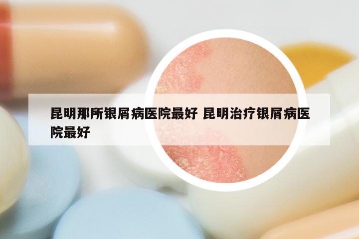 昆明那所银屑病医院最好 昆明治疗银屑病医院最好