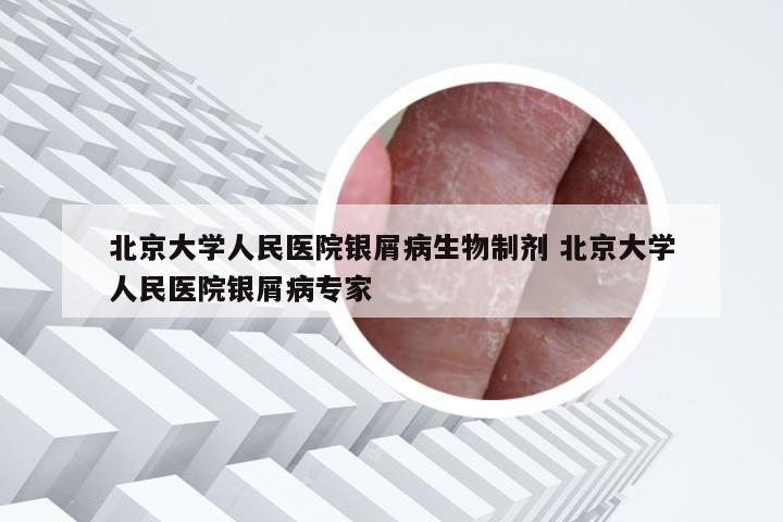 北京大学人民医院银屑病生物制剂 北京大学人民医院银屑病专家