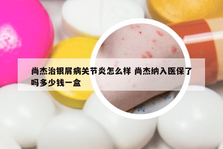尚杰治银屑病关节炎怎么样 尚杰纳入医保了吗多少钱一盒