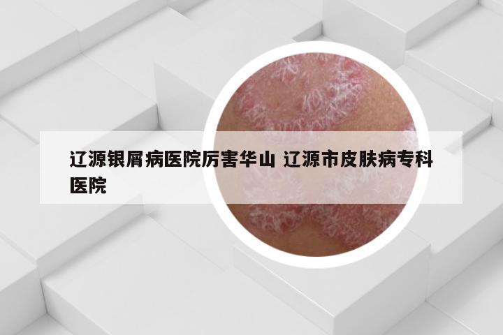 辽源银屑病医院厉害华山 辽源市皮肤病专科医院