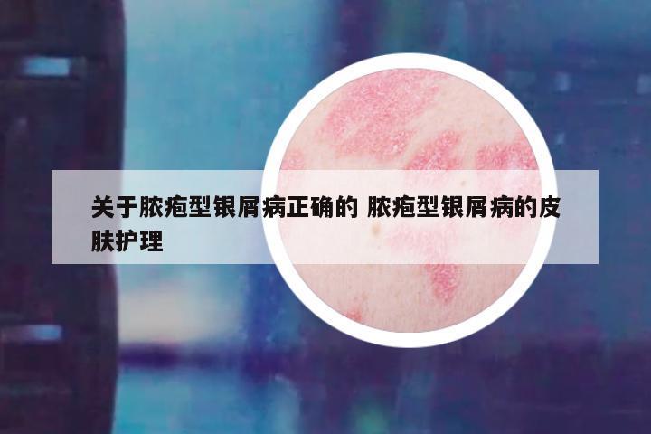 关于脓疱型银屑病正确的 脓疱型银屑病的皮肤护理