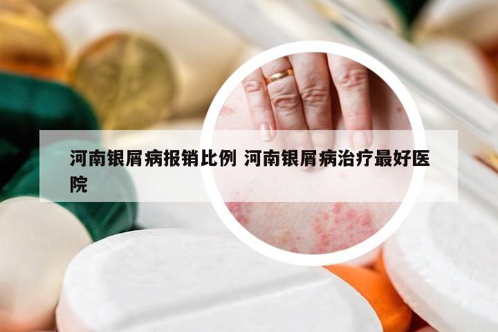 河南银屑病报销比例 河南银屑病治疗最好医院