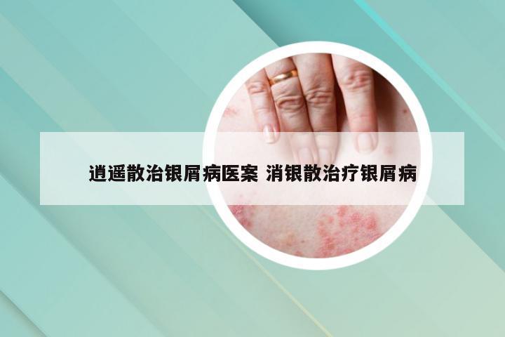 逍遥散治银屑病医案 消银散治疗银屑病