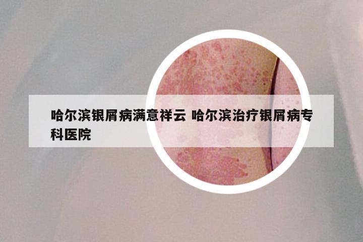 哈尔滨银屑病满意祥云 哈尔滨治疗银屑病专科医院