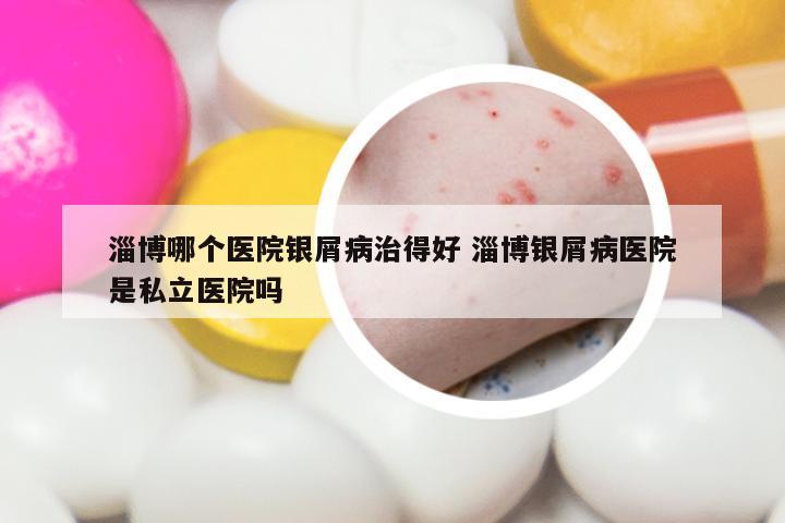 淄博哪个医院银屑病治得好 淄博银屑病医院是私立医院吗