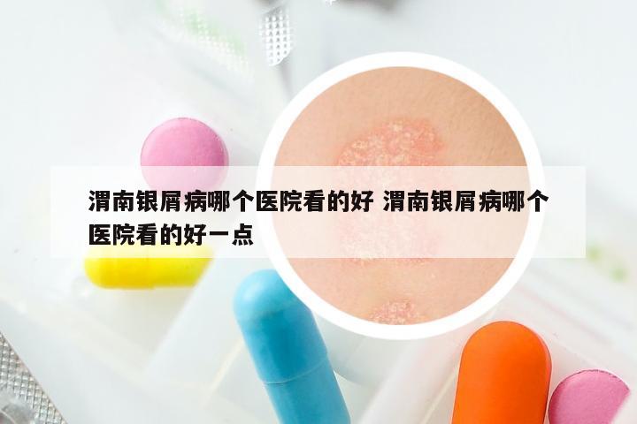渭南银屑病哪个医院看的好 渭南银屑病哪个医院看的好一点