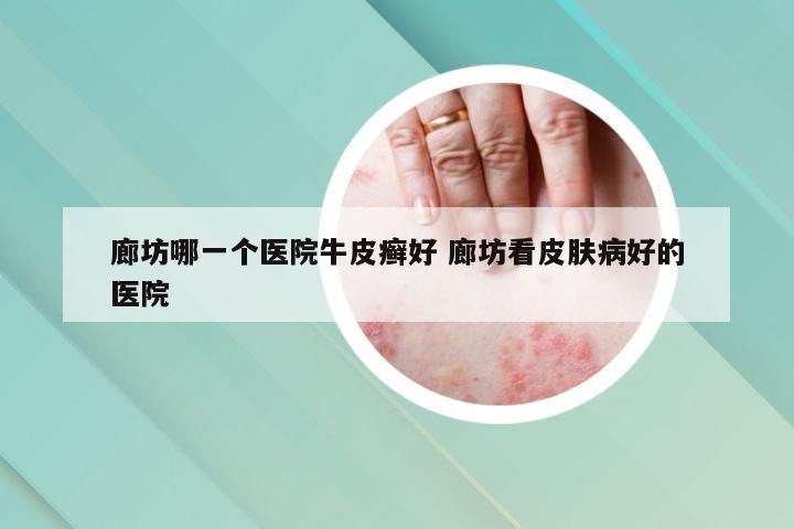 廊坊哪一个医院牛皮癣好 廊坊看皮肤病好的医院