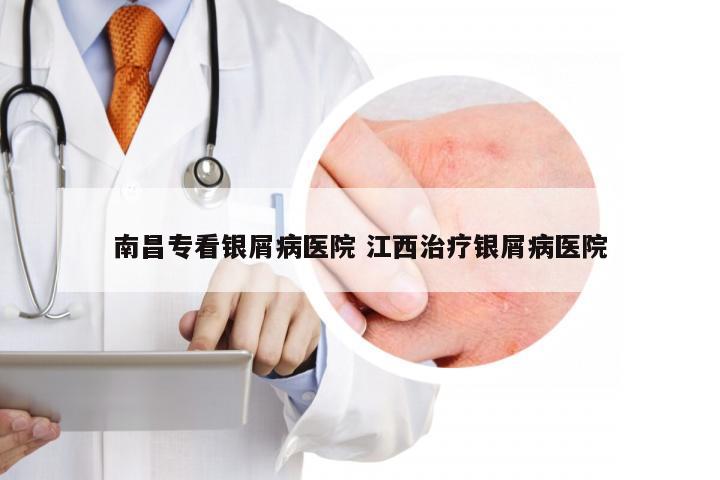 南昌专看银屑病医院 江西治疗银屑病医院