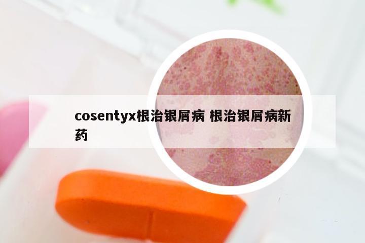 cosentyx根治银屑病 根治银屑病新药