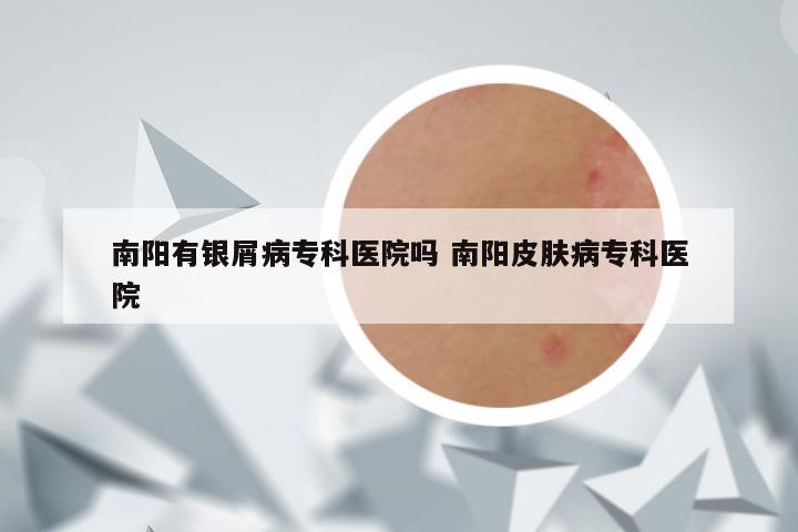 南阳有银屑病专科医院吗 南阳皮肤病专科医院