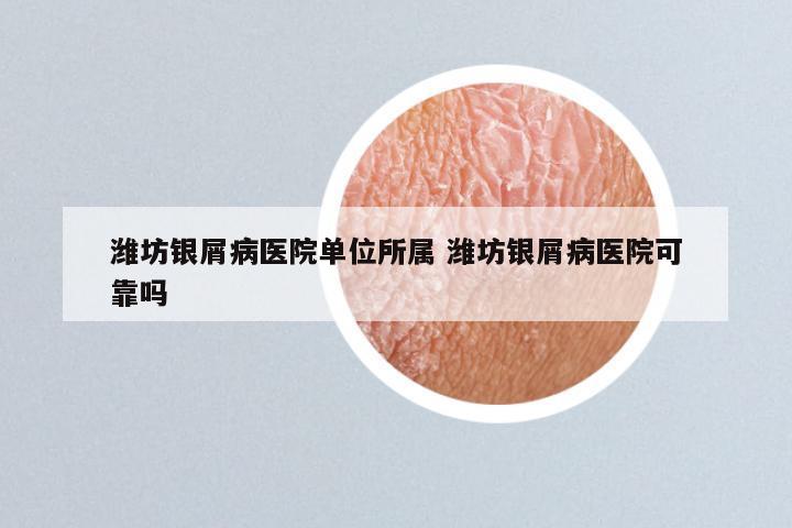 潍坊银屑病医院单位所属 潍坊银屑病医院可靠吗