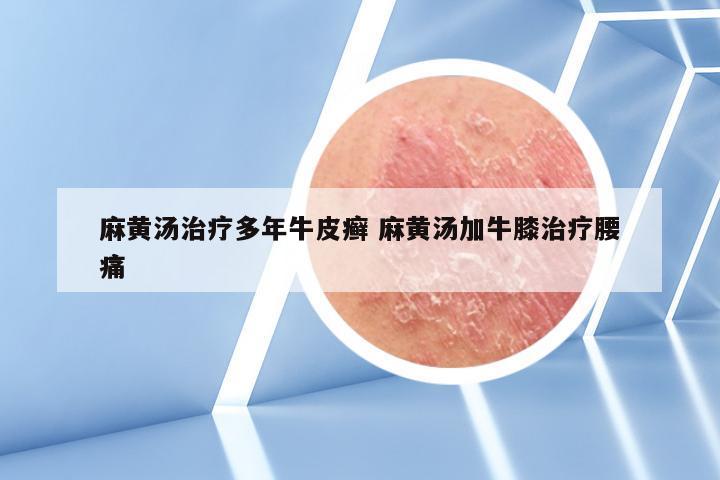 麻黄汤治疗多年牛皮癣 麻黄汤加牛膝治疗腰痛