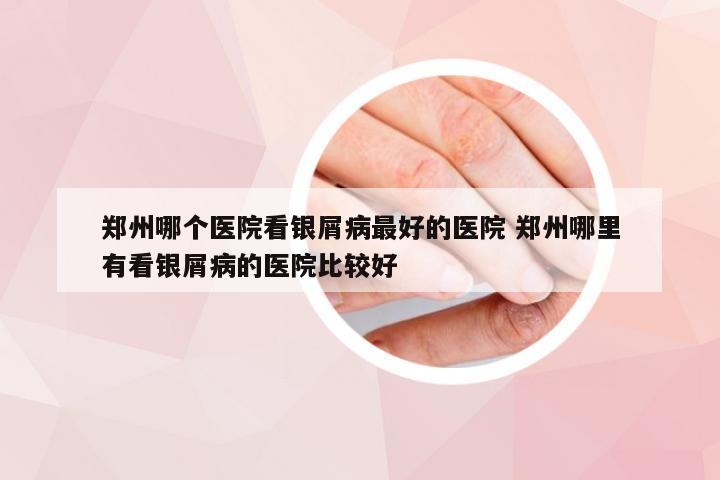 郑州哪个医院看银屑病最好的医院 郑州哪里有看银屑病的医院比较好