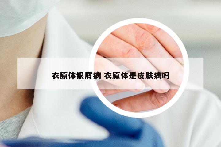 衣原体银屑病 衣原体是皮肤病吗