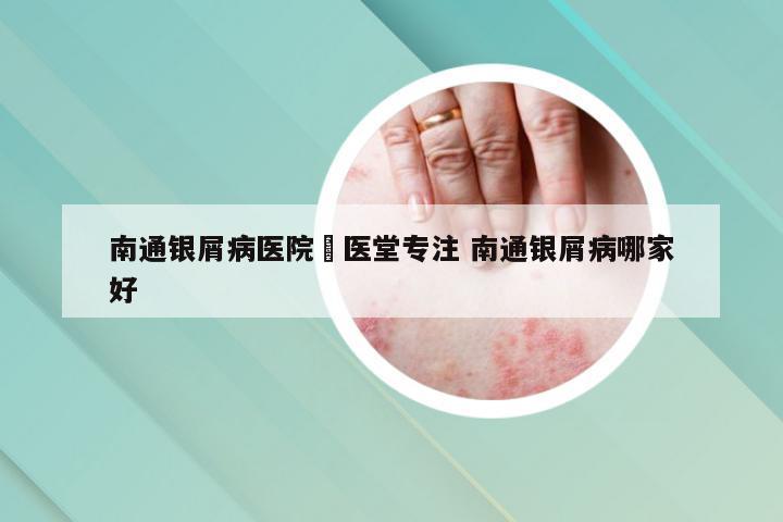 南通银屑病医院崋医堂专注 南通银屑病哪家好