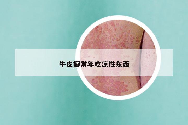 牛皮癣常年吃凉性东西