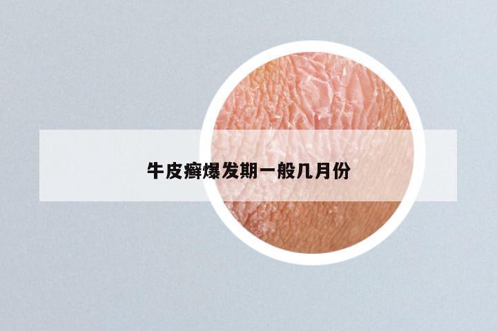 牛皮癣爆发期一般几月份