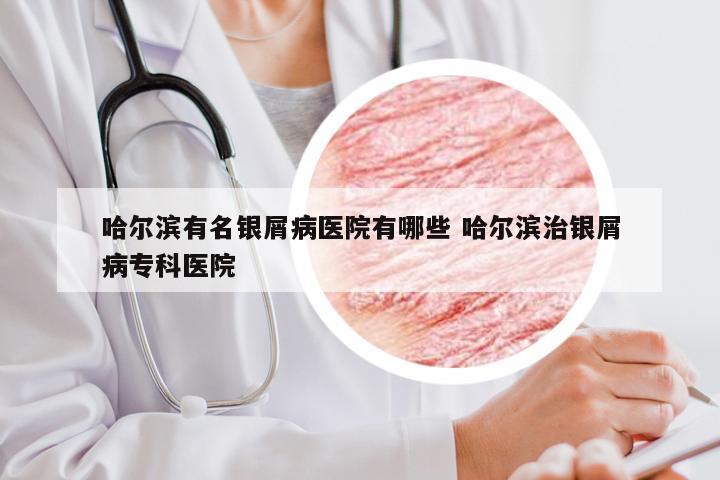 哈尔滨有名银屑病医院有哪些 哈尔滨治银屑病专科医院