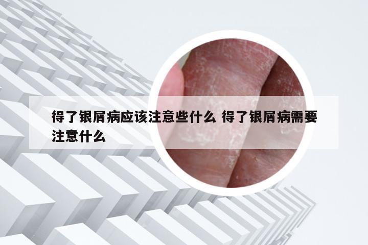 得了银屑病应该注意些什么 得了银屑病需要注意什么