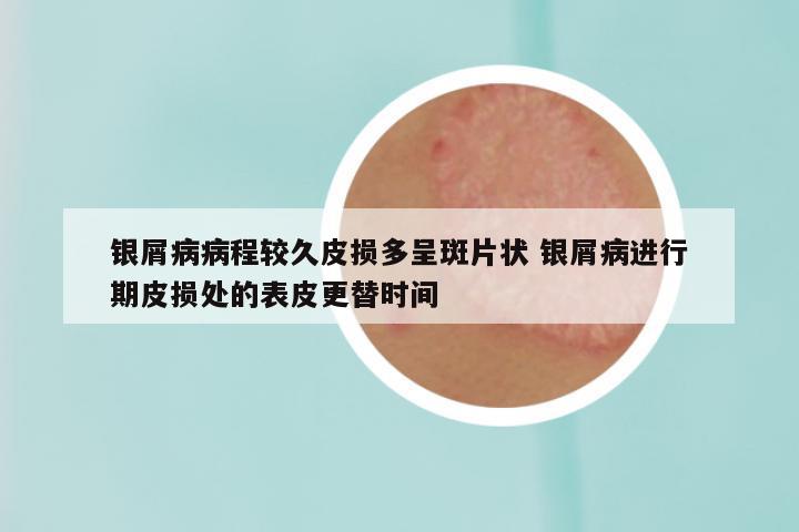 银屑病病程较久皮损多呈斑片状 银屑病进行期皮损处的表皮更替时间