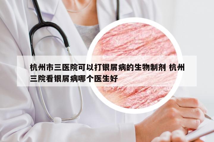杭州市三医院可以打银屑病的生物制剂 杭州三院看银屑病哪个医生好