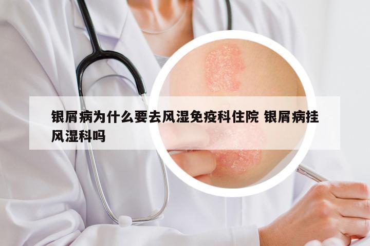 银屑病为什么要去风湿免疫科住院 银屑病挂风湿科吗