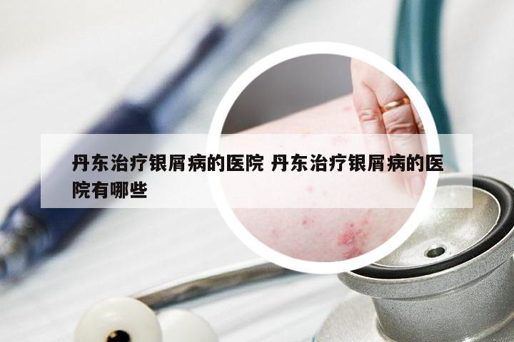 丹东治疗银屑病的医院 丹东治疗银屑病的医院有哪些