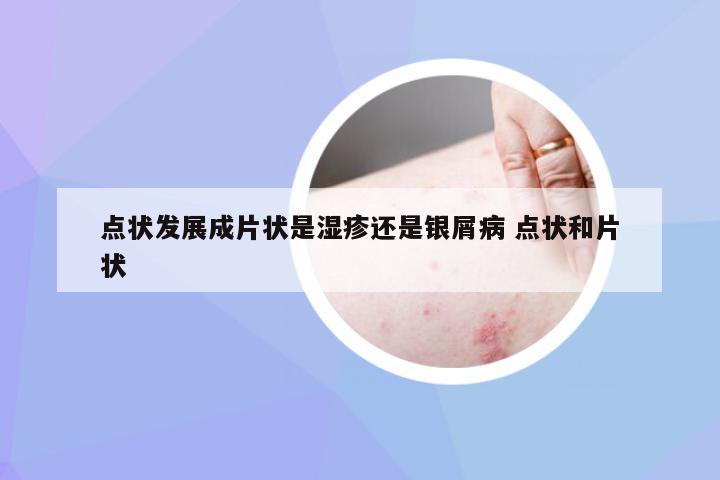 点状发展成片状是湿疹还是银屑病 点状和片状