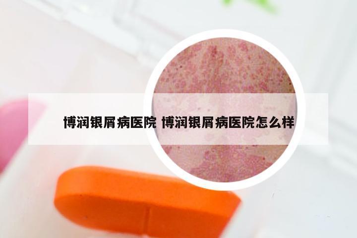 博润银屑病医院 博润银屑病医院怎么样