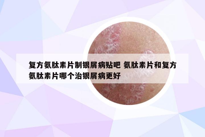 复方氨肽素片制银屑病贴吧 氨肽素片和复方氨肽素片哪个治银屑病更好