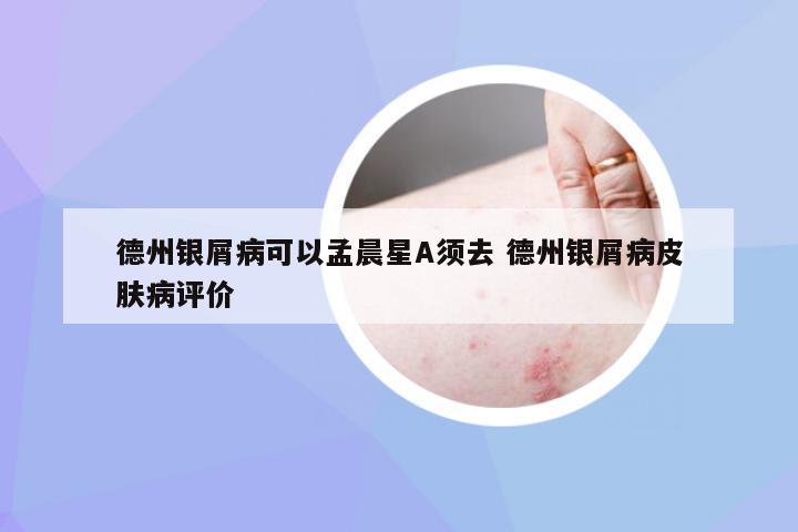 德州银屑病可以孟晨星A须去 德州银屑病皮肤病评价