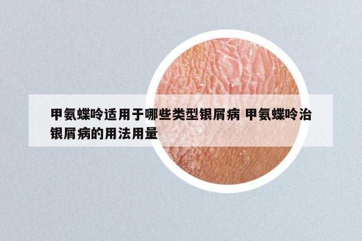 甲氨蝶呤适用于哪些类型银屑病 甲氨蝶呤治银屑病的用法用量