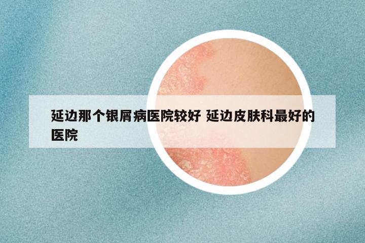延边那个银屑病医院较好 延边皮肤科最好的医院