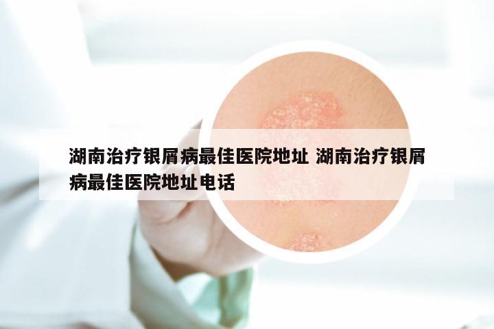 湖南治疗银屑病最佳医院地址 湖南治疗银屑病最佳医院地址电话