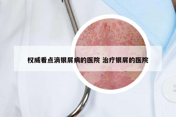 权威看点滴银屑病的医院 治疗银屑的医院