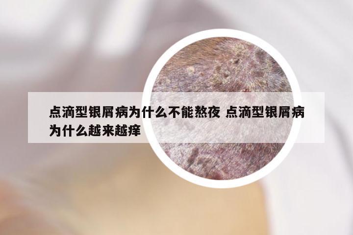 点滴型银屑病为什么不能熬夜 点滴型银屑病为什么越来越痒