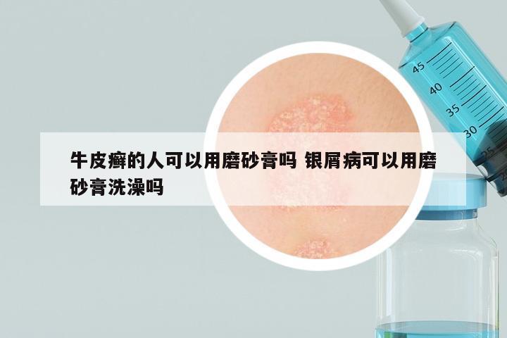 牛皮癣的人可以用磨砂膏吗 银屑病可以用磨砂膏洗澡吗