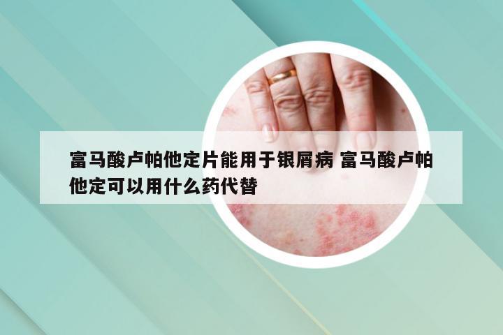 富马酸卢帕他定片能用于银屑病 富马酸卢帕他定可以用什么药代替