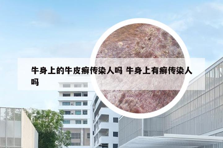 牛身上的牛皮癣传染人吗 牛身上有癣传染人吗