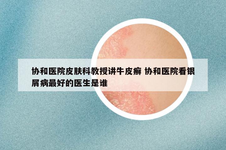 协和医院皮肤科教授讲牛皮癣 协和医院看银屑病最好的医生是谁